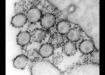 This transmission electron micrograph (TEM) depicts HIV-1 stained with ruthenium red to show surface glycoprotein knobs